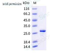 Sino Biological 501-TNNI0010 image 1