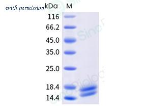 Sino Biological 336-ALT0010 image 1