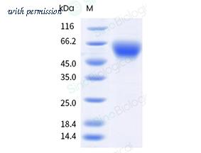 Sino Biological 10175-H49H-B image 1