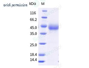 Sino Biological 10481-H08H-E image 1