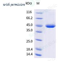 Sino Biological 13170-H07H3 image 1