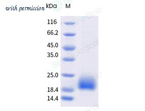 Sino Biological 91064-C44H-B image 1