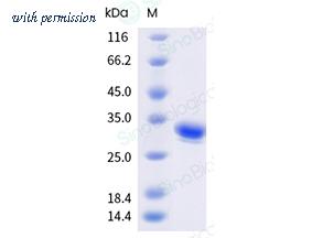 Sino Biological 212-SFTSV0030 image 1