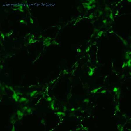 Sino Biological HG10384-CF image 1