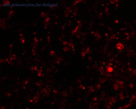 Sino Biological HG10400-ACR image 1
