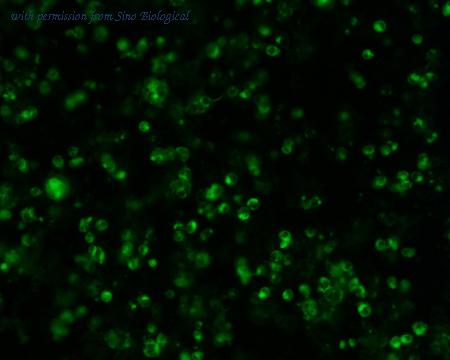 Sino Biological HG11612-ACG image 1