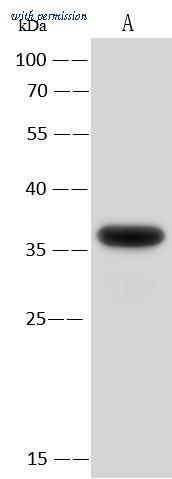 Sino Biological 10623-MM01 image 1