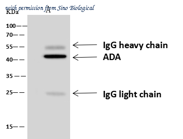 Sino Biological 14737-MM04 image 1