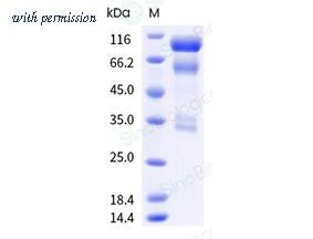 Sino Biological 10463-HNAS image 1