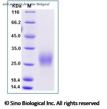 Sino Biological 50503-M08H-B image 1