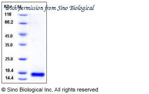 Sino Biological 50687-M08H image 1