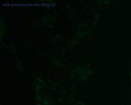 Sino Biological HG10805-ACG image 1
