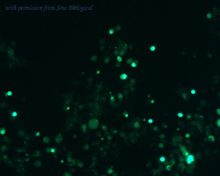 Sino Biological HG11846-ACG image 1