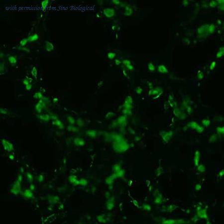 Sino Biological HG10058-CF image 1