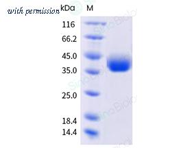 Sino Biological 40592-V49H21-B image 1