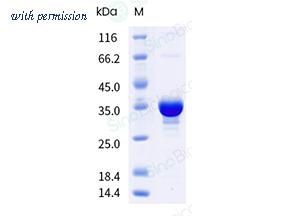 Sino Biological 41038-V44E-B image 1