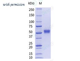 Sino Biological 51113-M02H-UE image 1