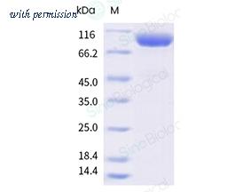 Sino Biological 10126-H02H-B image 1