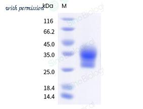 Sino Biological 10324-H49H-B image 1