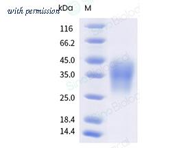 Sino Biological 10358-H08H image 1