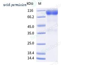 Sino Biological 10616-H02H-B image 1