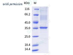 Sino Biological 11007-H08H-DD image 1