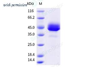 Sino Biological 11185-H08H3 image 1