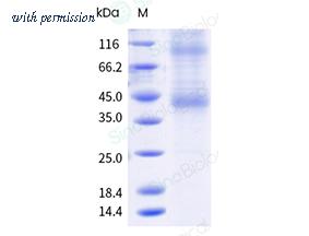 Sino Biological 11450-H18H-NA image 1