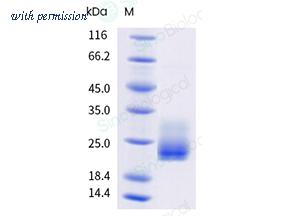 Sino Biological 11557-H07H image 1