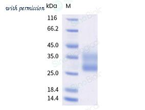 Sino Biological 11557-H56H-B image 1