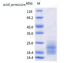 Sino Biological 16135-HNAH image 1