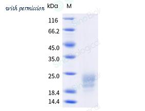 Sino Biological 16135-HNAH1 image 1
