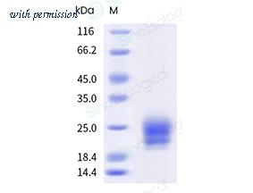 Sino Biological 16135-HNAH1-E image 1