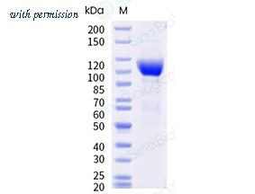 Sino Biological 17049-H01H2 image 1