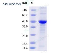 Sino Biological 40447-V44E-B image 1