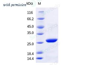 Sino Biological 40454-V44E-B image 1