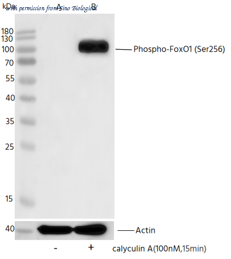 Sino Biological 111296-R0021 image 1