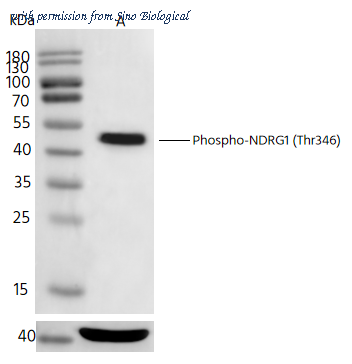 Sino Biological 112040-R0029 image 1