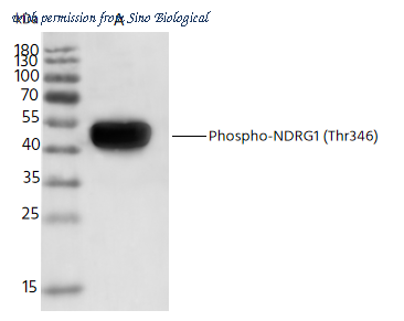Sino Biological 112040-R0031 image 1
