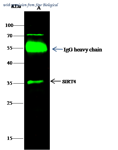 Sino Biological 10107-T48 image 1