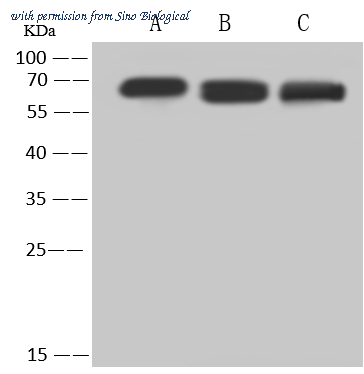 Sino Biological 11585-RP02 image 1