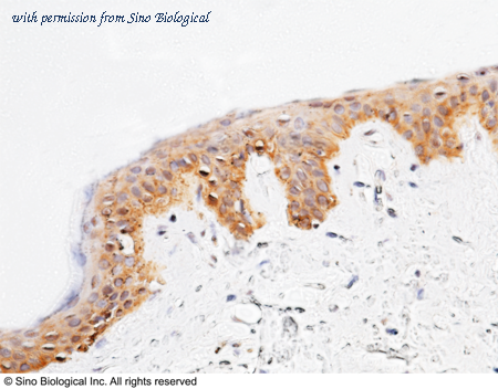 Sino Biological 11660-RP01 image 1
