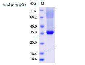 Sino Biological 10090-H49C-B image 1