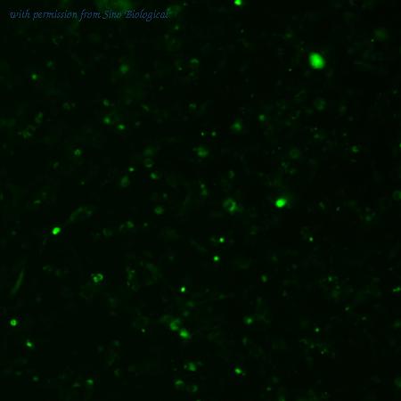 Sino Biological HG13798-ACG image 1