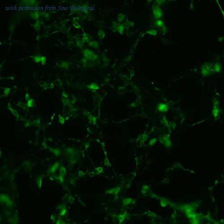 Sino Biological HG11585-CF image 1