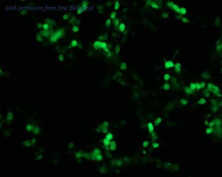 Sino Biological HG11209-ACG image 1