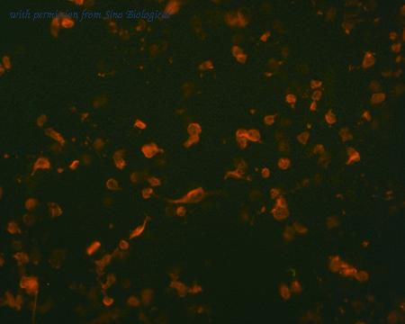 Sino Biological HG10606-NF image 1