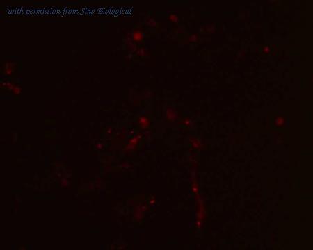 Sino Biological HG10551-ACR image 1