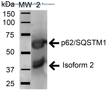 StressMarq Biosciences SPC-637D image 1